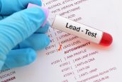 Monmouth County NJ Lead Poisoning Attorneys