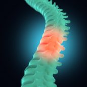 Spinal Cord Injury Attorneys Monmouth County, NJ