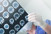 Symptoms and Causes of a Traumatic Brain Injury