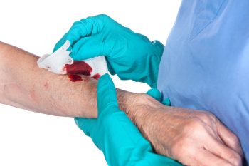 Cut and Laceration Claims in Monmouth County, New Jersey